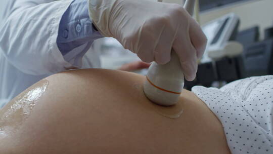 医生给孕妇做超声波检查视频素材模板下载