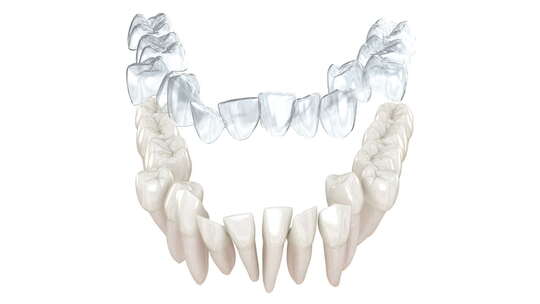 隐适美牙套或隐形保持器进行咬合矫正。3D