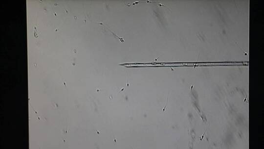 显微镜下的精子活动视频素材模板下载