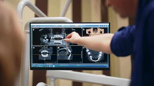 牙医在显示器上分析牙齿