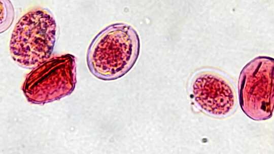 微生物显微镜观察绦虫卵