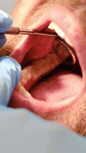 牙医检查男性牙齿提供口腔健康建议