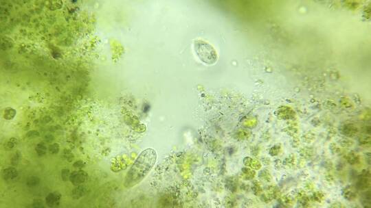 大量微生物纤毛虫 3