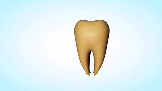 人体牙齿牙结石三维动画
