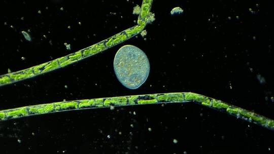 显微镜下的真实微生物