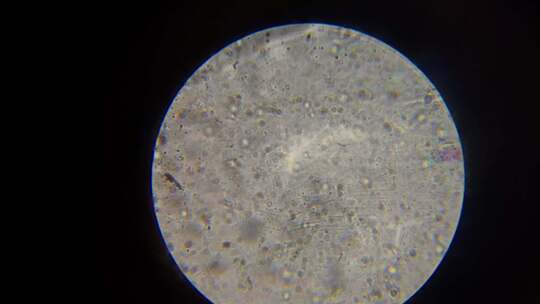 显微镜下精子运动3