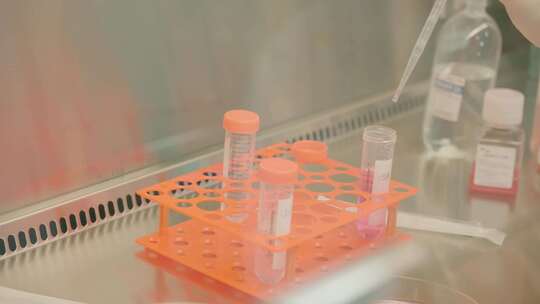实验员培养免疫细胞