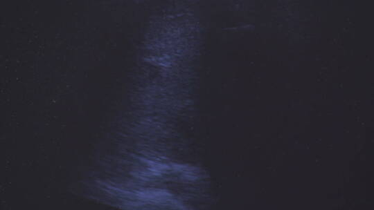 超声波扫描影像