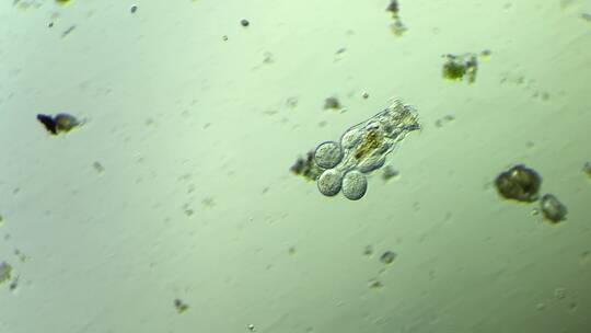 生命科学纪录片素材，显微镜下的生物，轮虫4