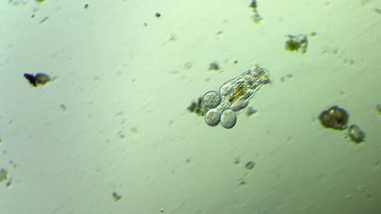 生命科学纪录片素材，显微镜下的生物，轮虫4视频素材模板下载