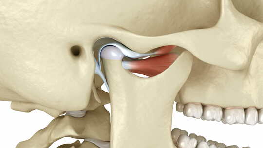 颞下颌关节和关节盘脱位。医学上精确的3D视频素材模板下载