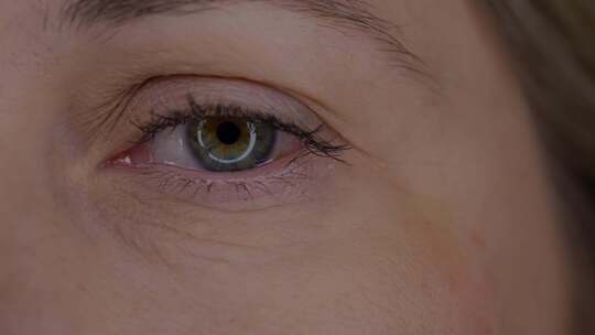 一名年轻女性的眼睛因长期使用小工具干眼综