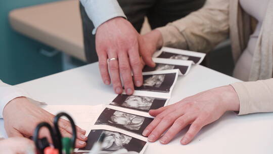 医生向孕妇展示超声波图像的特写镜头视频素材模板下载