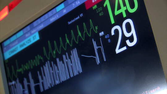 心电图的心脏跳动频率设备