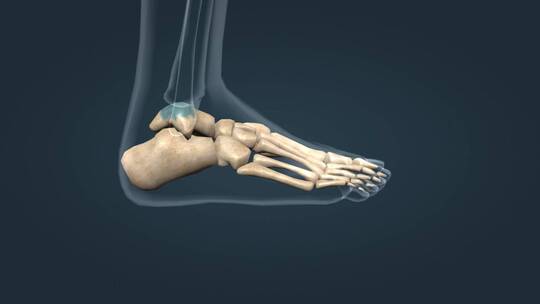 足部骨骼扁平足跟骨趾骨跖骨骨科足部畸形视频素材模板下载