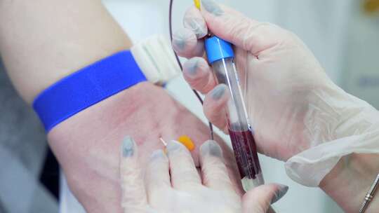 戴医用手套的女医生在医院采集患者血样检测冠状病毒