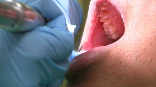 牙医为病人治疗牙齿