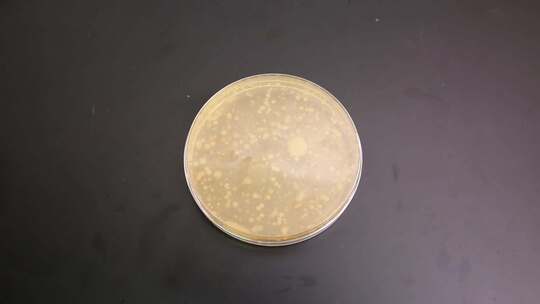 危险食品安全实验室检验菌落细菌培养皿