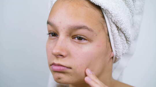 十几岁的女孩在浴巾上触摸有皮肤问题的脸