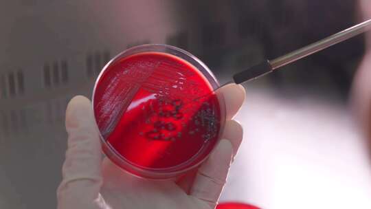 医院微生物实验室在培养皿上转种菌种视频素材模板下载