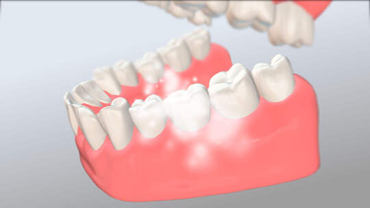 清理牙齿三维