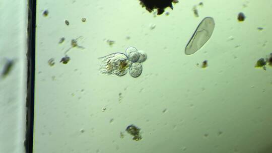 生命科学纪录片素材，显微镜下的生物，轮虫3