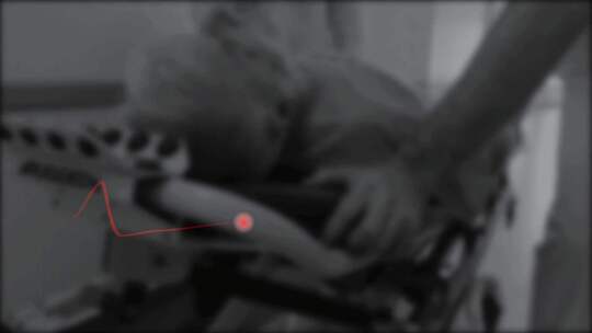 老年人心脏病发作医院抢救心跳心电图