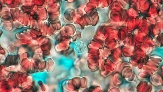 红细胞，显微，血细胞，人体