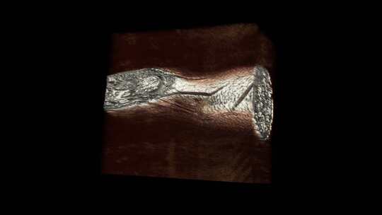 腕部核磁 手腕MRI影像 三维切片 8视频素材模板下载