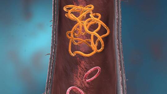 细菌真菌细胞微生物显微镜下病菌形态