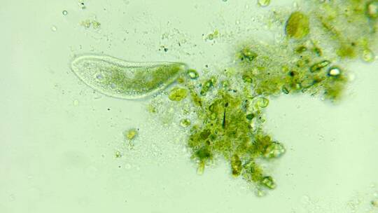 微生物纤毛虫细菌单细胞原生生物视频素材模板下载