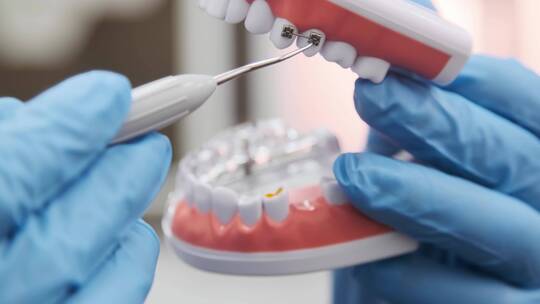 牙医展示如何放置牙套的模型