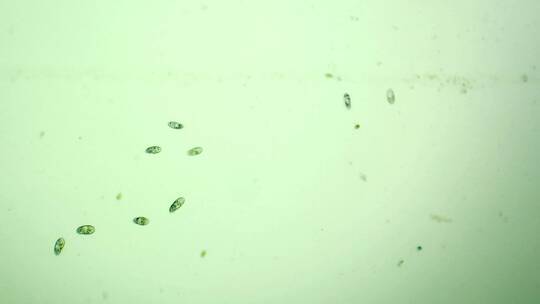 微生物纤毛虫