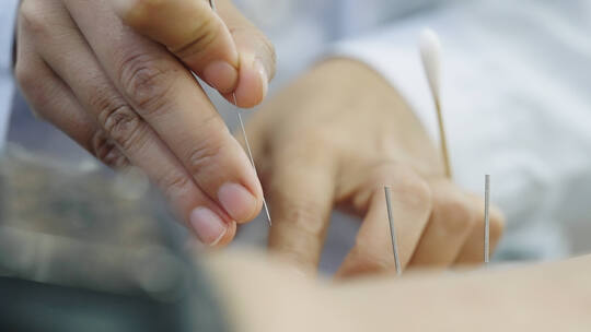 中医针灸