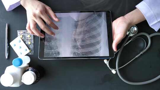 医生在平板电脑上分析肺部X射线图像视频素材模板下载