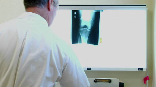 医生检查X光片视频素材模板下载