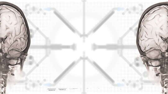 X光人体骨骼器官数据信息采集HUD视频