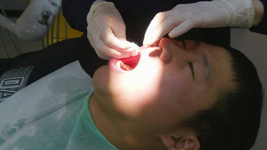 亚洲人口腔护理整牙洗牙