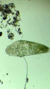 微分干涉DIC显微镜放大100倍的微生物喇叭虫细胞2