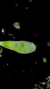 显微镜放大100倍的微生物喇叭虫细胞