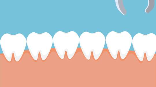 蛀牙拔出的医学动画