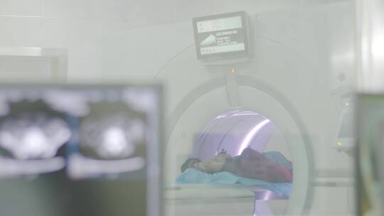 智能医疗设备照CT放射科