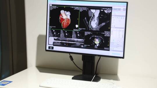 核磁共振CT医疗设备东软医疗