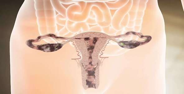 妇科疾病 三维女性健康 卵巢 乳腺增生