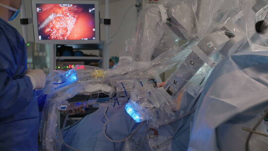 医院的微创机器人手术视频素材模板下载