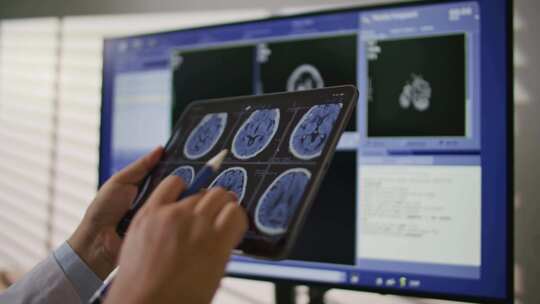 特写医生在平板电脑上分析MRI扫描片视频素材模板下载