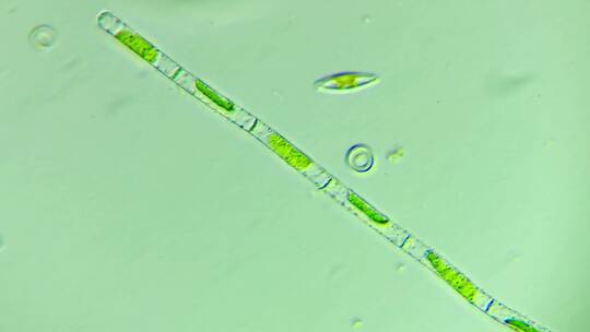 生物科普科研素材 连成一串的硅藻2
