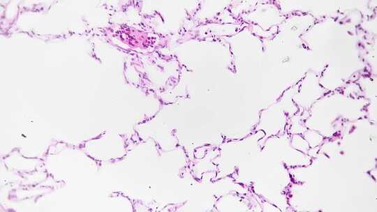 在200倍放大的显微镜下观察人肺组织载玻