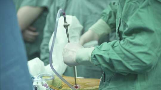 腔镜手术 手术室 医生 患者 手术器械