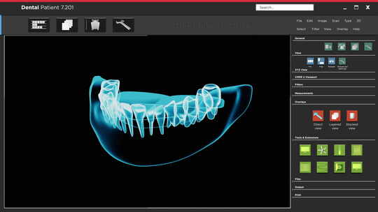 软件应用程序用户界面与牙科X光扫描的界面